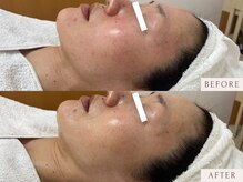 クラームビューティー(Clerm beauty)/【40代 女性】鎮静フェイシャル