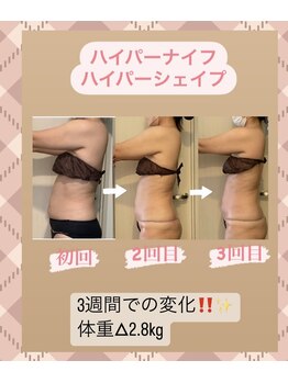 アローナ(ARONA)/3回での結果です！