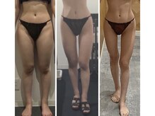 短期間で本気の結果出し！ダイエットはチェセデュラスで決まり！