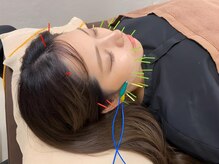 フェリス(Feliz)/電気美容鍼でさらに効果UP