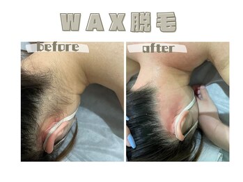 レヴィート(Revept)/【ワックス脱毛】