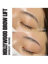 ソル 日吉台 成田駅前(Sol)/ハリウッドブロウリフト