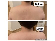 サロン ド レーヴ(Salon de Reve)/【お客様の事例】Billy’s Care