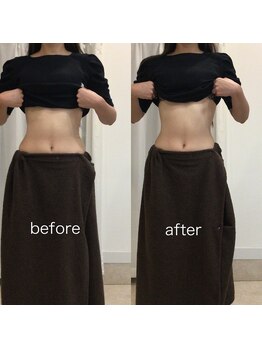 ジョワイユ(Joyeux)/腸の位置でお腹は変わる