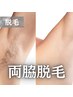【都度払い脱毛】両ワキ脱毛　1回1,650円 
