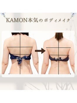 カモン(KAMON)の写真/【姿勢・体型崩れは根本改善で変わる】肩こり・頭痛の不調も解消！骨格と筋膜の矯正で理想体型と美姿勢