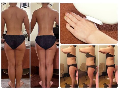 レヴィ(Revie)の写真