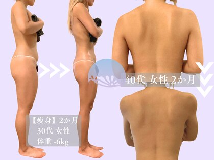 ベルペール(Belle perle)の写真