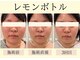 エトワール 天王寺(etoile)の写真