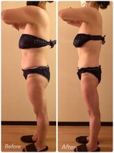 チェイン オブ フラワー(Chain Of Flower)/【脂肪ごっそり!?】薄く細く