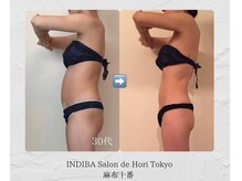 インディバホリトウキョウ(INDIBA HORI TOKYO)/産後ケア。他に類のないスゴ技