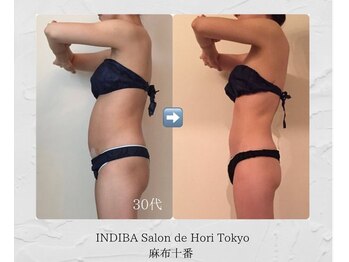 インディバホリトウキョウ(INDIBA HORI TOKYO)/産後ケア。他に類のないスゴ技