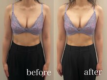 ソセイラボエステティック(SOSEI Lab. esthetic)/