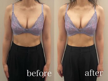 ソセイラボエステティック(SOSEI Lab. esthetic)/