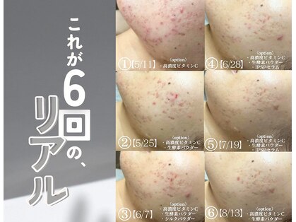 ソアスキン(SOAskin)の写真