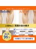 【ワンランク上の魅せる体へ♪】全身脱毛＋顔全体脱毛＋VIO脱毛 19800円