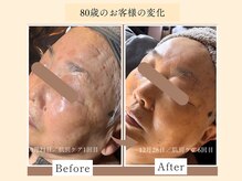 パンセリーノ(Panselinos)/何歳からでも貴女らしい美しさを