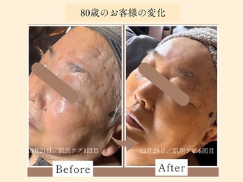 パンセリーノ(Panselinos)/何歳からでも貴女らしい美しさを
