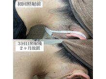 テンパ ビューティー(+10%beauty)/効果写真