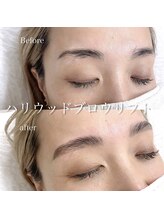 アンナボーテ(Anna beate)/ハリウッドブロウリフト