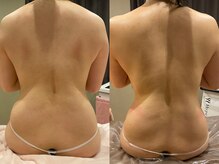 エス シークレット 金町店(S secret)/自主努力で限界だったけど解決へ