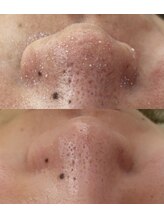 スイ 四条烏丸(SUI)/〇ハイドロスプラッシュ