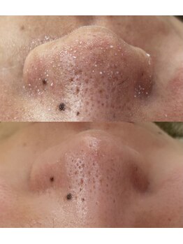 スイ 四条烏丸(SUI)/〇ハイドロスプラッシュ