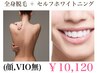全身美肌脱毛( 顔,VIO無 )¥14,300→¥10,120+セルフホワイトニングプレゼント
