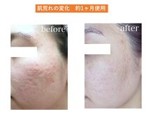 マーナ 谷山笹貫店(Ma-Na)/シワシミケアフェイシャルで美肌