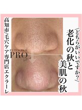 エクラーレ(Eclale)/【毛穴ケア】症例