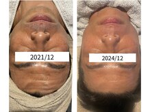 インチャント(enchant)/40代メンズ　大人なの肌悩み