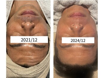 インチャント(enchant)/40代メンズ 大人なの肌悩み