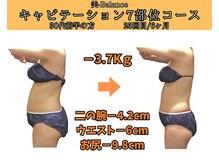 ビーバランス 本町店(美-Balance)/30代前半　月7部位コース