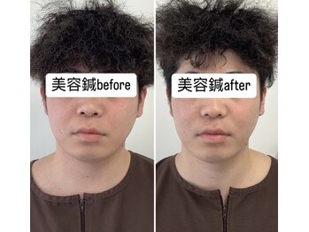 ハリサロンドオフ 堺東店(hari salon de off)/お客様before→after
