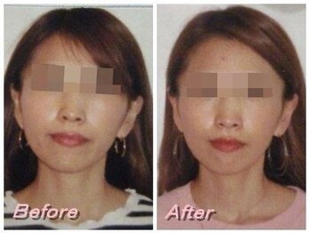 ドクター ヴィーナス/歪み改善の症例