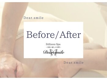 ディアスマイル(Dear.smile)/Dear.smileのBefore/After