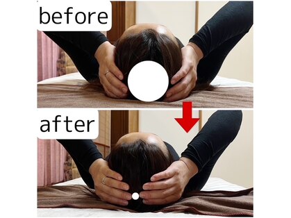 オステオデイジー(OsteoDaisy)の写真