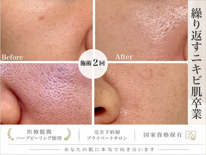 ビオエル(Bee'oele)の写真