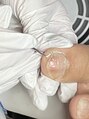ネイルージュ&nbsp;食い込んだお爪のケア。しませんか？