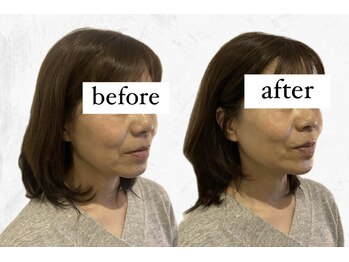 ビーアイリー(Be irie)/フェイシャルエステ直後の変化