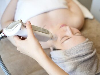 ユソン(YSN)の写真/フェイスラインが気になる方に♪たるみケアでフェイスラインを引き締めキュッと小顔に☆