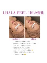 ベル(BELL)/ピーリングで艶肌とリフトアップ