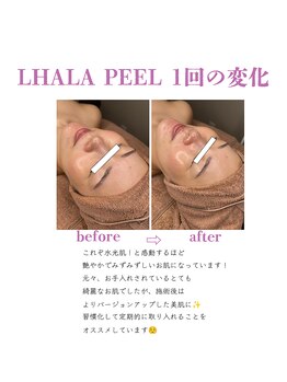 ベル(BELL)/ピーリングで艶肌とリフトアップ