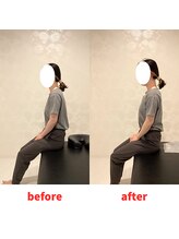 ナオル整体 福岡香椎院(NAORU整体)/20代女性施術事例【巻肩改善】