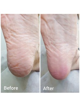 リゼラアンドコー 神戸店/