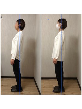 トリデ 合志店(TORIDE)/整体コースのお客様の変化2
