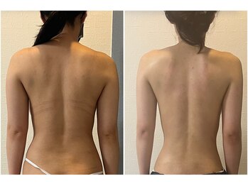 モア(moa)/夏はくびれ欲しくない！？