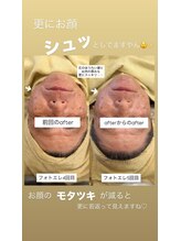 クレール 小山店(CLAIR)/【美肌フォト+エレポレ】