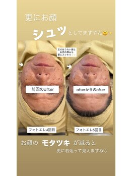 クレール 小山店(CLAIR)/【美肌フォト+エレポレ】