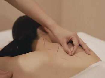 はりと美容鍼灸治療院(HaRi&美容鍼灸治療院)の写真/【首・肩こり徹底改善】オリジナルメゾットで首肩周りのツボを刺激し血行促進！極上の癒しをお届けします☆